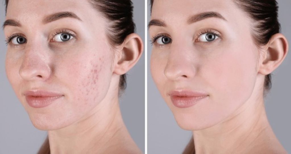 Before and after transformation highlighting skincare, fitness, and fashion improvements